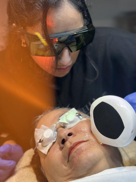 IPL-photofacial(1) IPL-photofacial(1)