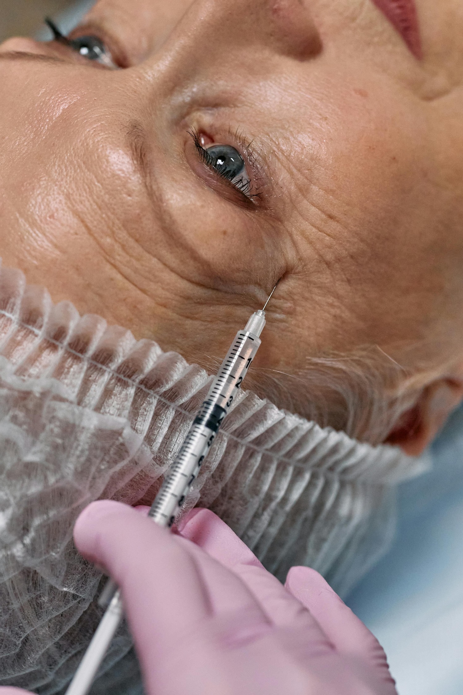 Wrinkles and fine lines