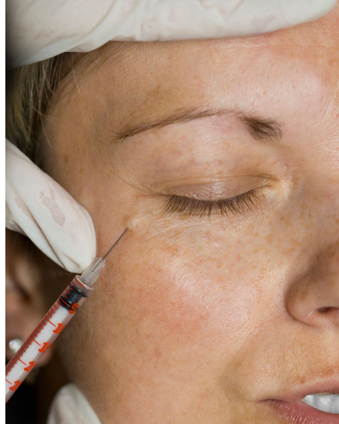 aesthetic face injectables